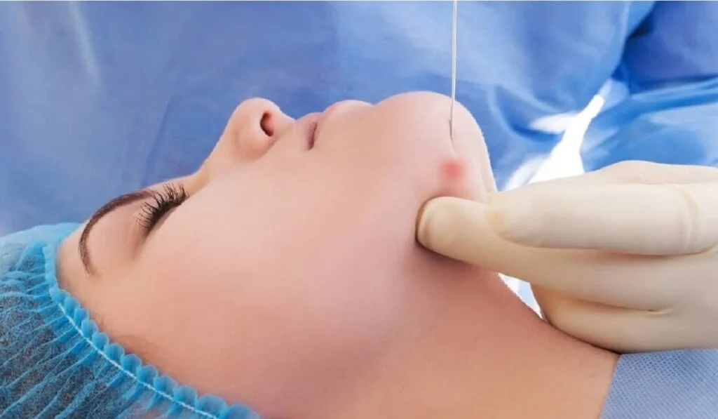 Endolaser X Esteticista: Saiba Tudo!